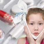 Parotite epidemica (orecchioni)